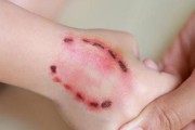 狂犬病的征兆及预防措施（探索狂犬病的征兆与应对之策）