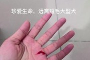 打了狗针后多久才能怀孕？（了解狗针对怀孕的影响及注意事项）