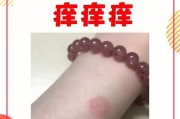 猫癣传染给人该怎么办？（一招轻松治好猫癣，保护您和您的猫咪的健康！）