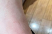 猫咪咬人的原因及应对方法（了解猫咪咬人的情况，给予适当的应对与关爱）