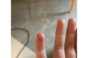 如何预防被小狗咬伤？（宠物狗的养护与预防措施）