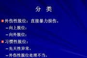 髌骨脱位（解析髌骨脱位的原因、治疗和预防）